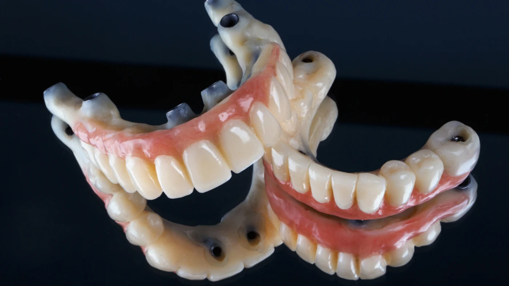 full arch dental implants in crestview fl