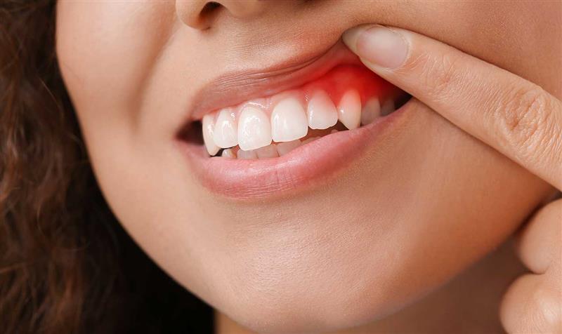 gum disease treatment in crestview fl