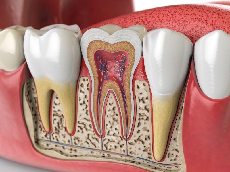 root canal therapy in crestview fl