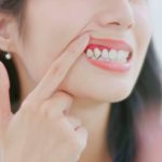 symptoms of gum disease to never ignore