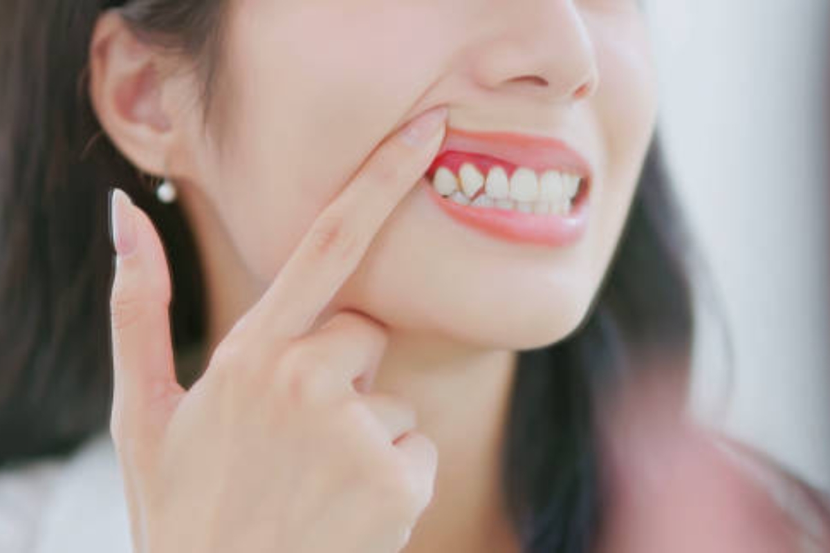 symptoms of gum disease to never ignore