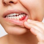 What Are the Warning Signs of Gum Disease?