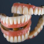 What Is Full-Arch Dental Implant Treatment and Who May Need It?